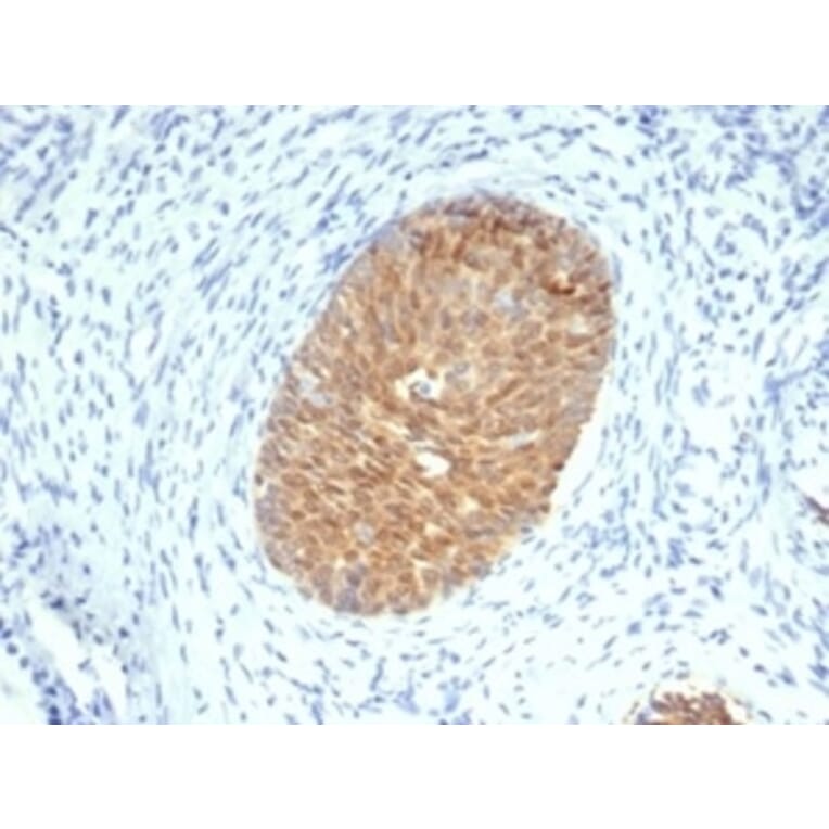 Immunohistochemistry - Anti-Maspin Antibody [SERPINB5/4975] - BSA and Azide free (A278333) - Antibodies.com