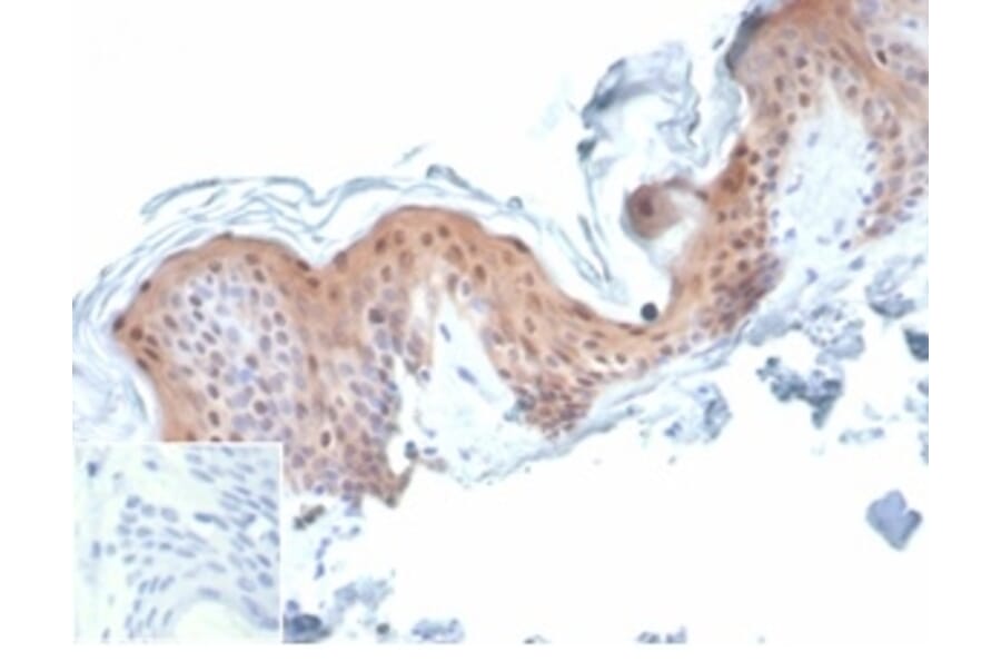 Immunohistochemistry - Anti-Maspin Antibody [SERPINB5/4977] - BSA and Azide free (A278334) - Antibodies.com