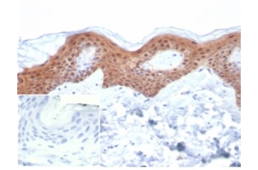 Immunohistochemistry - Anti-Maspin Antibody [SERPINB5/4979] - BSA and Azide free (A278335) - Antibodies.com