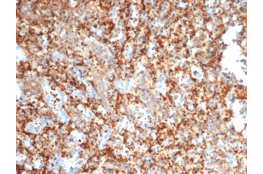 Immunohistochemistry - Anti-PI 3 Kinase p85 beta Antibody [PIK3R2/292] - BSA and Azide free (A278336) - Antibodies.com