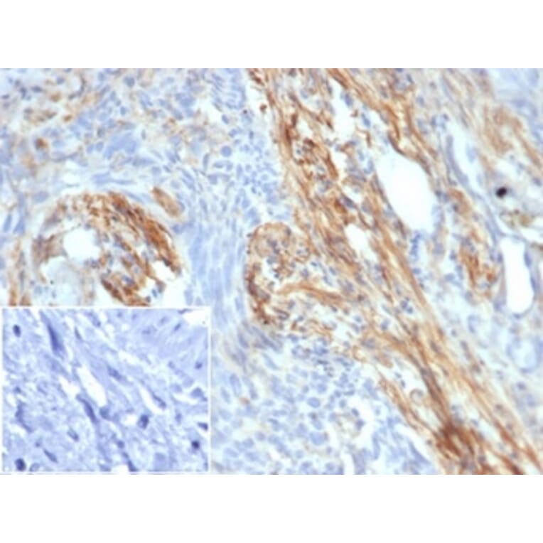 Immunohistochemistry - Anti-PI 3 Kinase p85 beta Antibody [PIK3R2/292] - BSA and Azide free (A278336) - Antibodies.com