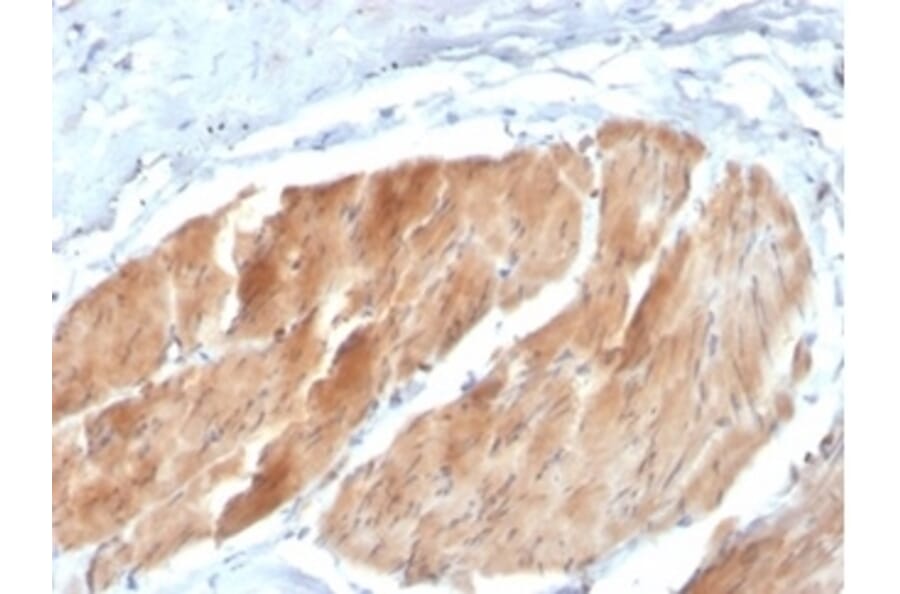 Immunohistochemistry - Anti-PI 3 Kinase p85 beta Antibody [PIK3R2/1293] - BSA and Azide free (A278337) - Antibodies.com
