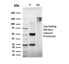 SDS-PAGE - Anti-BCL11A Antibody [PCRP-BCL11A-1G10] - BSA and Azide free (A278338) - Antibodies.com