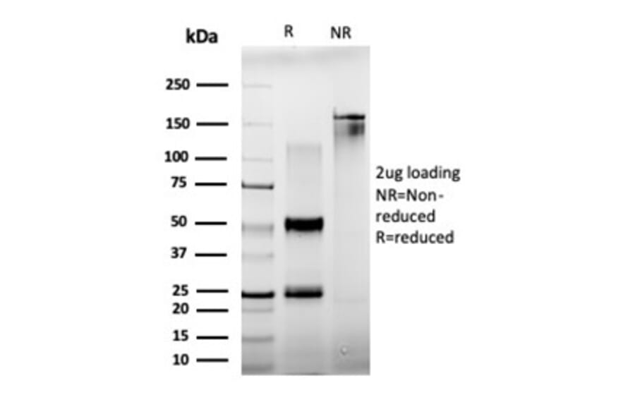 SDS-PAGE - Anti-BCL11A Antibody [PCRP-BCL11A-1G10] - BSA and Azide free (A278338) - Antibodies.com