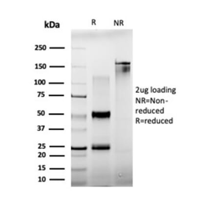 SDS-PAGE - Anti-BCL11A Antibody [PCRP-BCL11A-1G10] - BSA and Azide free (A278338) - Antibodies.com