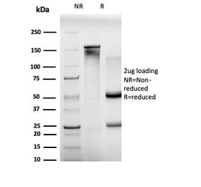 SDS-PAGE - Anti-BCL11A Antibody [PCRP-BCL11A-1H3] - BSA and Azide free (A278339) - Antibodies.com