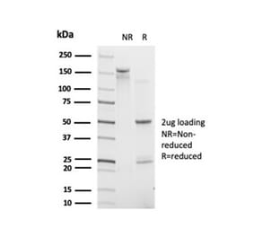 SDS-PAGE - Anti-CHRAC17 Antibody [PCRP-POLE3-3D3] - BSA and Azide free (A278341) - Antibodies.com