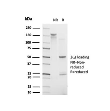 SDS-PAGE - Anti-CHRAC17 Antibody [PCRP-POLE3-3D3] - BSA and Azide free (A278341) - Antibodies.com