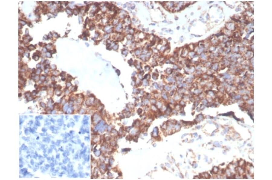Immunohistochemistry - Anti-TREM2 Antibody [TREM2/7210] - BSA and Azide free (A278342) - Antibodies.com