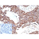 Immunohistochemistry - Anti-TREM2 Antibody [TREM2/7210] - BSA and Azide free (A278342) - Antibodies.com
