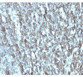 Immunohistochemistry - Anti-Migfilin Antibody [FBLIM1/4600] - BSA and Azide free (A278346) - Antibodies.com