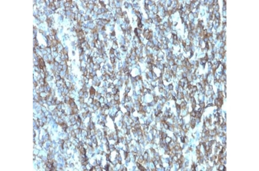 Immunohistochemistry - Anti-Migfilin Antibody [FBLIM1/4600] - BSA and Azide free (A278346) - Antibodies.com