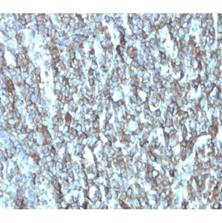 Immunohistochemistry - Anti-Migfilin Antibody [FBLIM1/4600] - BSA and Azide free (A278346) - Antibodies.com