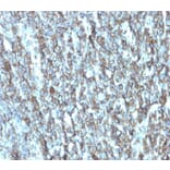 Immunohistochemistry - Anti-Migfilin Antibody [FBLIM1/4600] - BSA and Azide free (A278346) - Antibodies.com