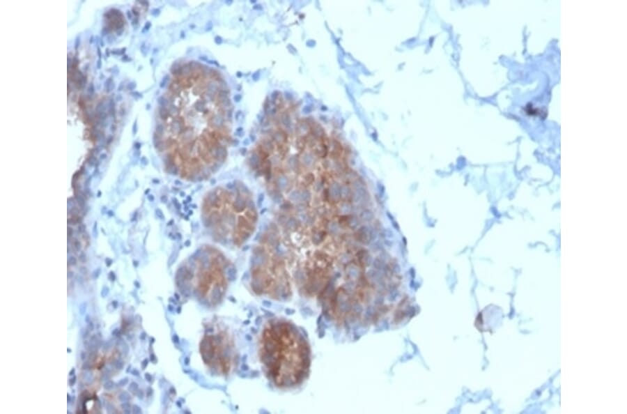 Immunohistochemistry - Anti-Migfilin Antibody [FBLIM1/4600] - BSA and Azide free (A278346) - Antibodies.com