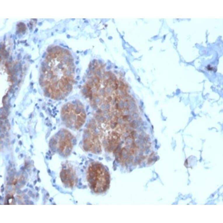 Immunohistochemistry - Anti-Migfilin Antibody [FBLIM1/4600] - BSA and Azide free (A278346) - Antibodies.com
