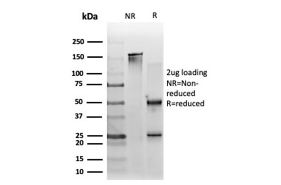 SDS-PAGE - Anti-ZNF562 Antibody [PCRP-ZNF562-1A1] - BSA and Azide free (A278347) - Antibodies.com