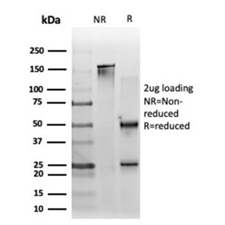 SDS-PAGE - Anti-ZNF562 Antibody [PCRP-ZNF562-1A1] - BSA and Azide free (A278347) - Antibodies.com