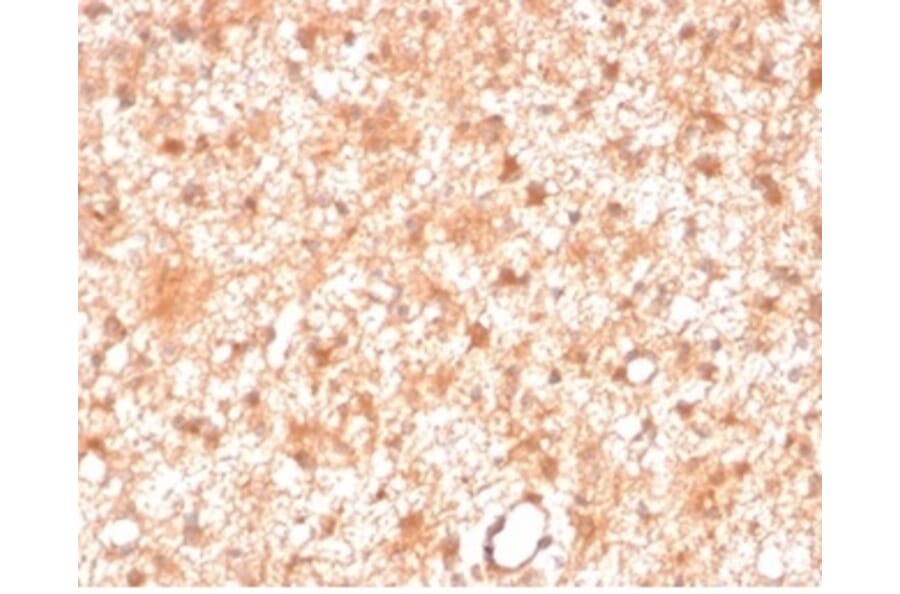 Immunohistochemistry - Anti-PKC iota Antibody [PRKCI/4911] - BSA and Azide free (A278351) - Antibodies.com