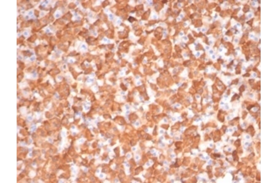 Immunohistochemistry - Anti-PKC iota Antibody [PRKCI/4911] - BSA and Azide free (A278351) - Antibodies.com