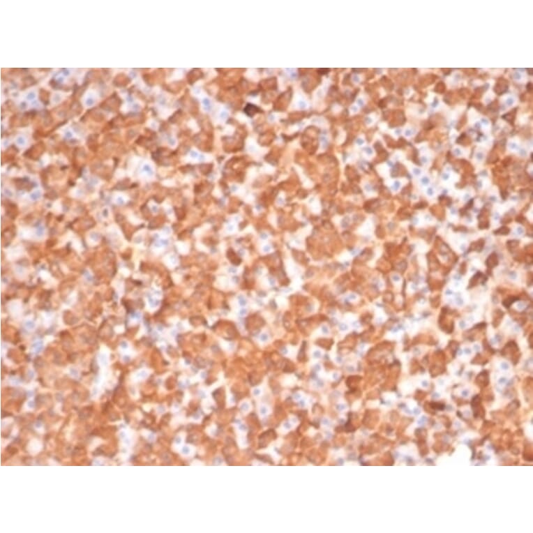 Immunohistochemistry - Anti-PKC iota Antibody [PRKCI/4911] - BSA and Azide free (A278351) - Antibodies.com