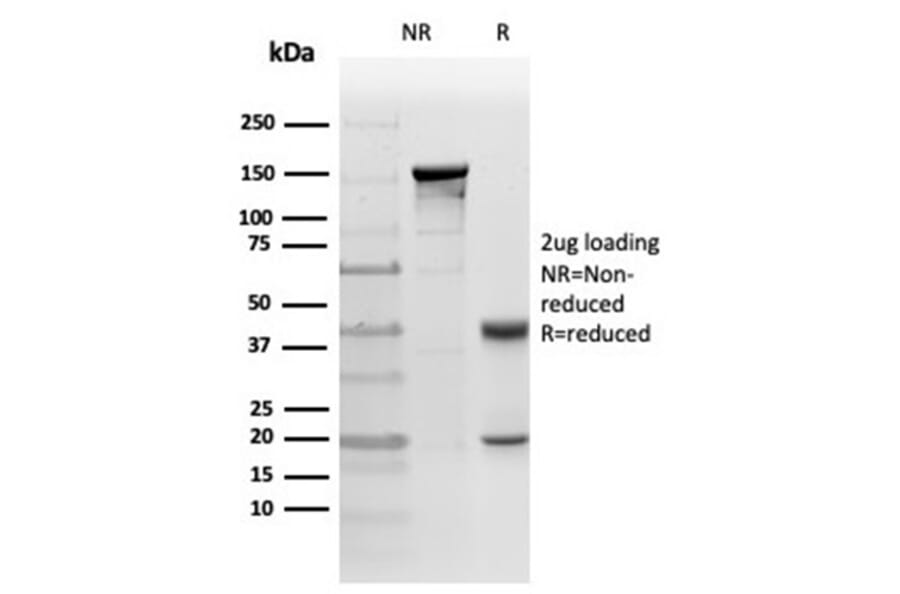 Immunohistochemistry - Anti-PKC iota Antibody [PRKCI/4911] - BSA and Azide free (A278351) - Antibodies.com