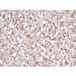 Immunohistochemistry - Anti-PKC iota Antibody [PRKCI/4912] - BSA and Azide free (A278352) - Antibodies.com