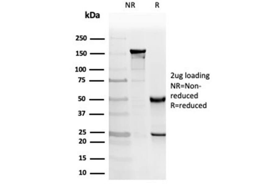 SDS-PAGE - Anti-PKC iota Antibody [PRKCI/4912] - BSA and Azide free (A278352) - Antibodies.com