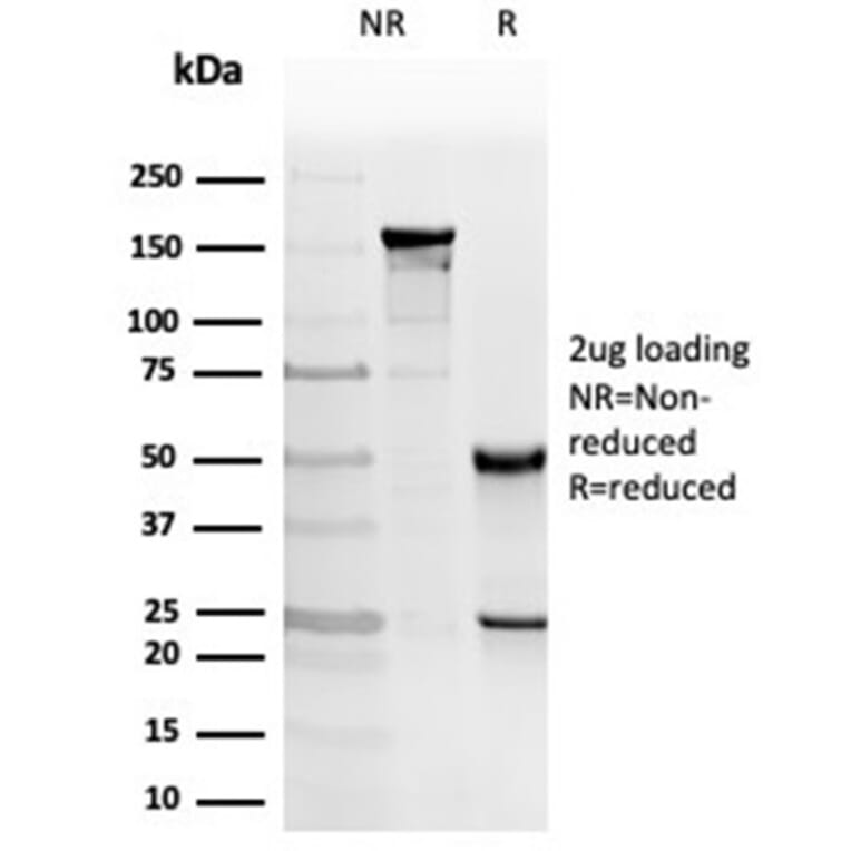 SDS-PAGE - Anti-PKC iota Antibody [PRKCI/4912] - BSA and Azide free (A278352) - Antibodies.com