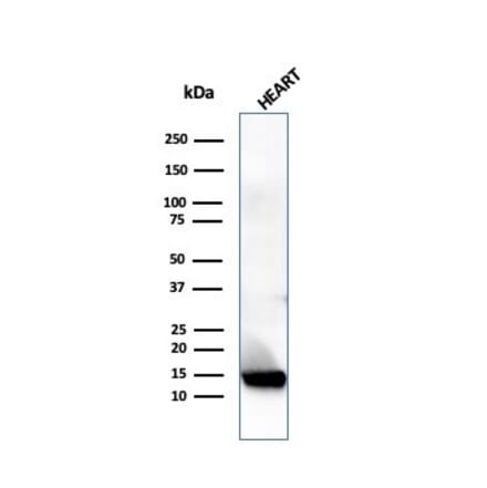 Western Blot - Anti-Resistin Antibody [RETN/4324] - BSA and Azide free (A278355) - Antibodies.com