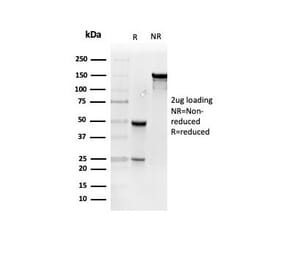 SDS-PAGE - Anti-Resistin Antibody [RETN/4327] - BSA and Azide free (A278356) - Antibodies.com