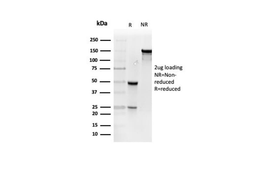 SDS-PAGE - Anti-Resistin Antibody [RETN/4327] - BSA and Azide free (A278356) - Antibodies.com