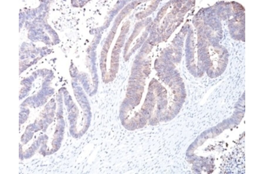 Immunohistochemistry - Anti-COX2 Antibody [COX2/2377] - BSA and Azide free (A278357) - Antibodies.com
