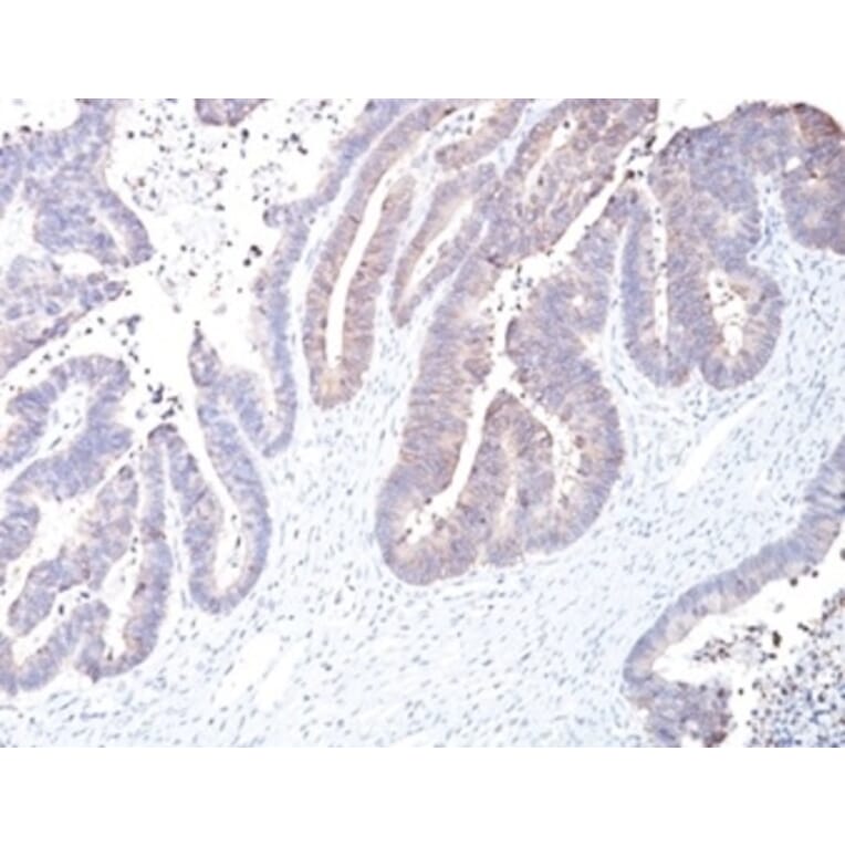 Immunohistochemistry - Anti-COX2 Antibody [COX2/2377] - BSA and Azide free (A278357) - Antibodies.com