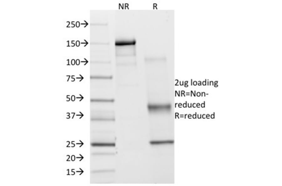 Immunohistochemistry - Anti-COX2 Antibody [COX2/2377] - BSA and Azide free (A278357) - Antibodies.com