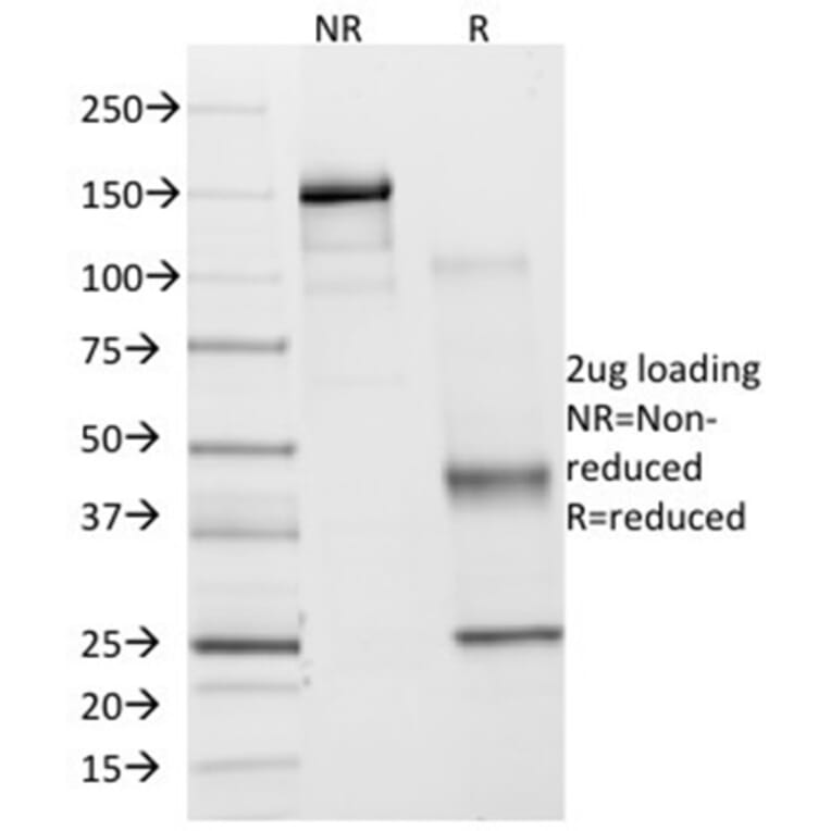 Immunohistochemistry - Anti-COX2 Antibody [COX2/2377] - BSA and Azide free (A278357) - Antibodies.com