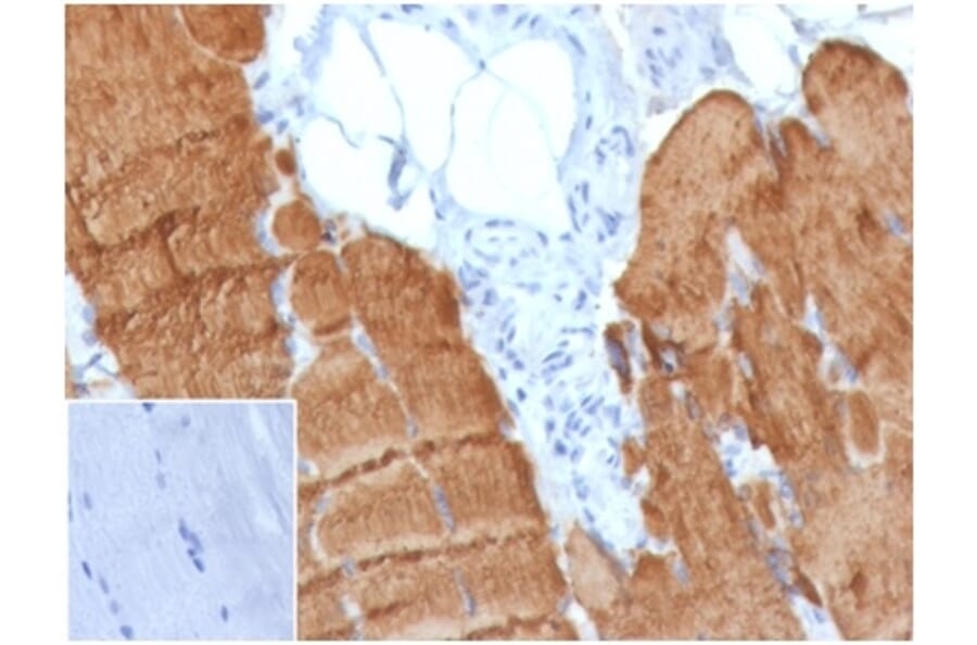Immunohistochemistry - Anti-alpha Skeletal Muscle Actin Antibody [ACTA1/360] - BSA and Azide free (A278358) - Antibodies.com