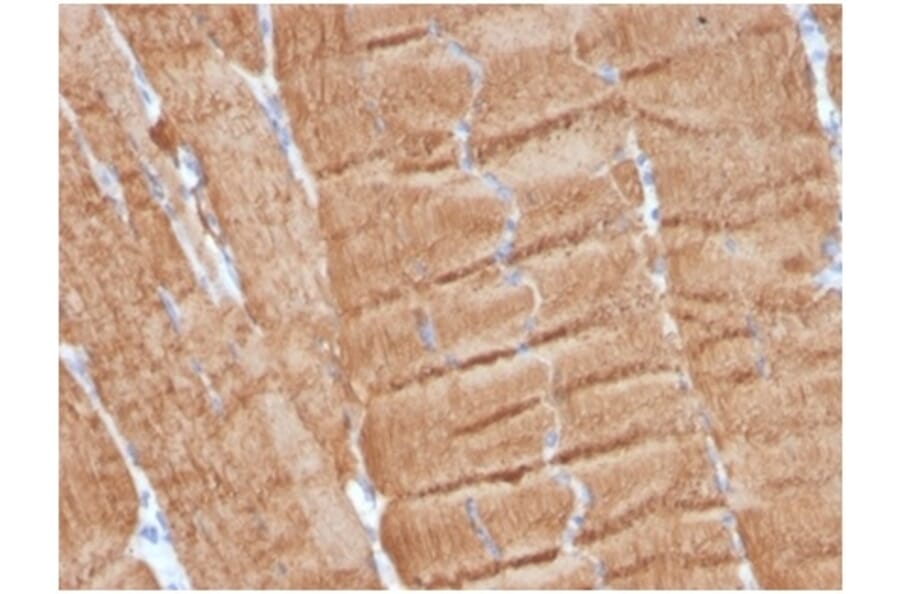 Immunohistochemistry - Anti-alpha Skeletal Muscle Actin Antibody [ACTA1/360] - BSA and Azide free (A278358) - Antibodies.com