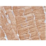 Immunohistochemistry - Anti-alpha Skeletal Muscle Actin Antibody [ACTA1/360] - BSA and Azide free (A278358) - Antibodies.com