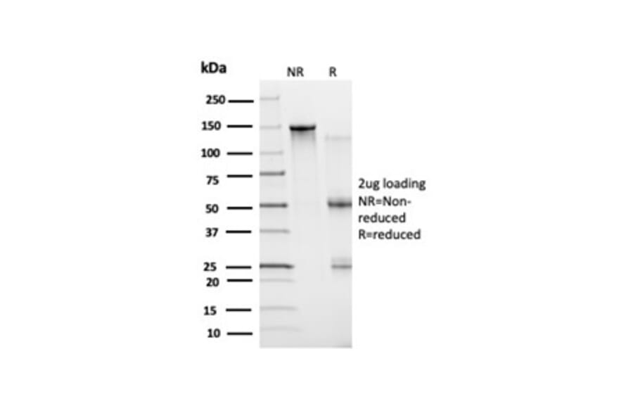 SDS-PAGE - Anti-Bcl-6 Antibody [PCRP-BCL6-1D3] - BSA and Azide free (A278363) - Antibodies.com