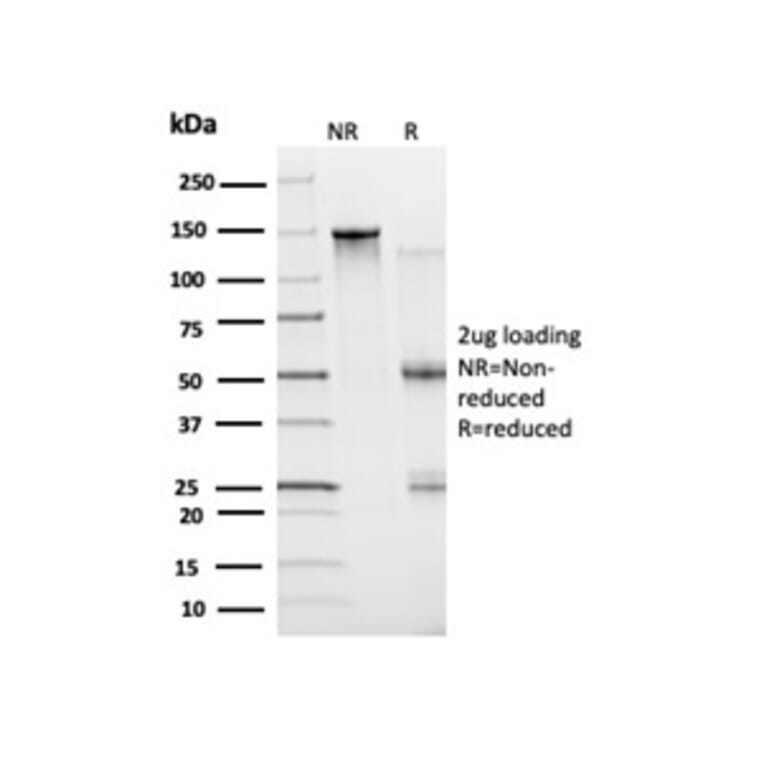 SDS-PAGE - Anti-Bcl-6 Antibody [PCRP-BCL6-1D3] - BSA and Azide free (A278363) - Antibodies.com