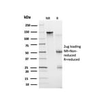 SDS-PAGE - Anti-Bcl-6 Antibody [PCRP-BCL6-1D3] - BSA and Azide free (A278363) - Antibodies.com