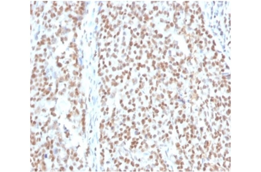 Immunohistochemistry - Anti-RPA2 Antibody [RPA2/4774] - BSA and Azide free (A278365) - Antibodies.com