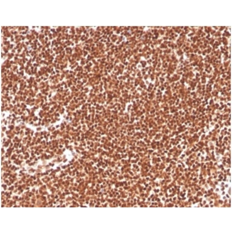 Immunohistochemistry - Anti-RPA2 Antibody [RPA2/4774] - BSA and Azide free (A278365) - Antibodies.com