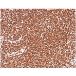 Immunohistochemistry - Anti-RPA2 Antibody [RPA2/4774] - BSA and Azide free (A278365) - Antibodies.com