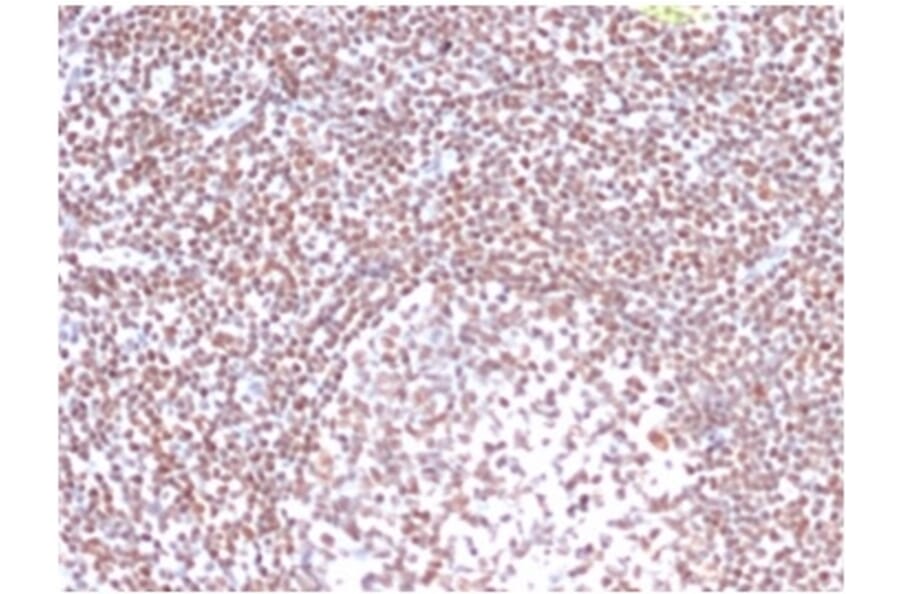 Immunohistochemistry - Anti-RPA2 Antibody [RPA2/4774] - BSA and Azide free (A278365) - Antibodies.com