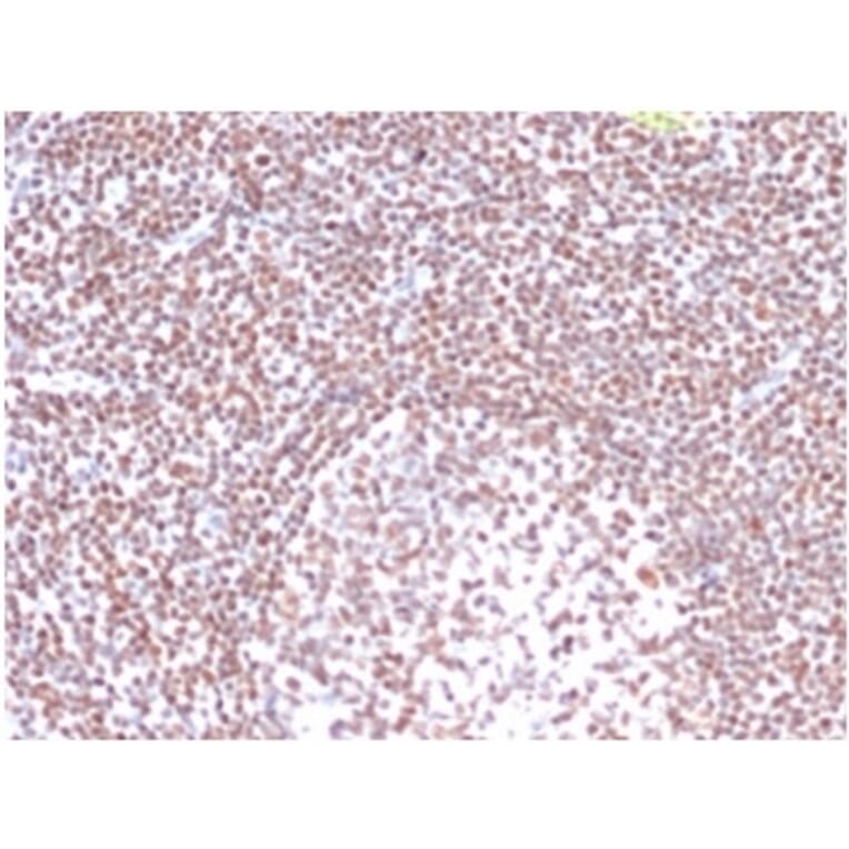 Immunohistochemistry - Anti-RPA2 Antibody [RPA2/4774] - BSA and Azide free (A278365) - Antibodies.com