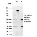 SDS-PAGE - Anti-RPA2 Antibody [RPA2/4774] - BSA and Azide free (A278365) - Antibodies.com