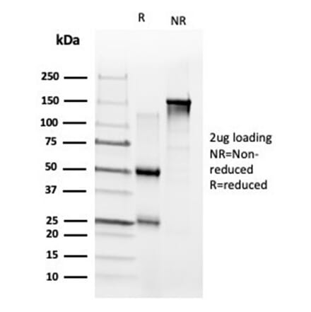 SDS-PAGE - Anti-ZNF704 Antibody [PCRP-ZNF704-3C10] - BSA and Azide free (A278366) - Antibodies.com