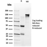 SDS-PAGE - Anti-ZNF704 Antibody [PCRP-ZNF704-3C10] - BSA and Azide free (A278366) - Antibodies.com